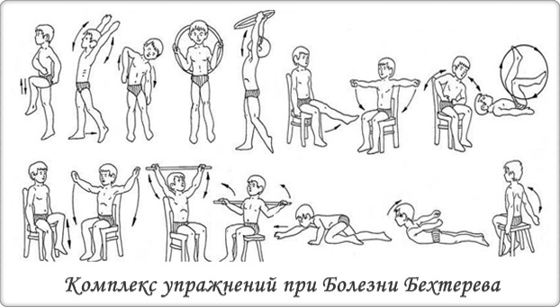 gimnastika-pri-bolezni-behtereva