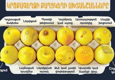 Կրծքագեղձի քաղցկեղը չարորակ ուռուցք է, որը սկսվում է կրծքագեղձի բջիջներում