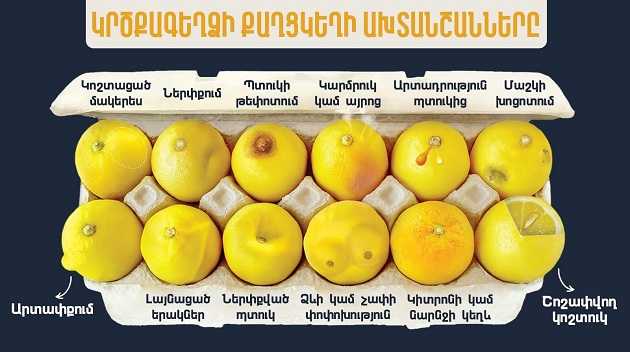 Կրծքագեղձի քաղցկեղը չարորակ ուռուցք է, որը սկսվում է կրծքագեղձի բջիջներում