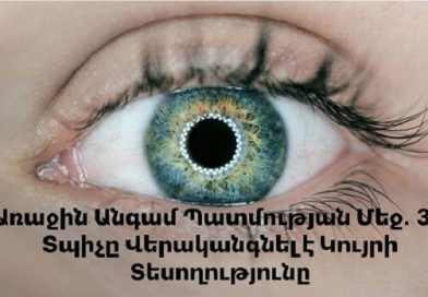 Առաջին Անգամ Պատմության Մեջ․ 3D Տպիչը Վերականգնել է Կույրի Տեսողությունը