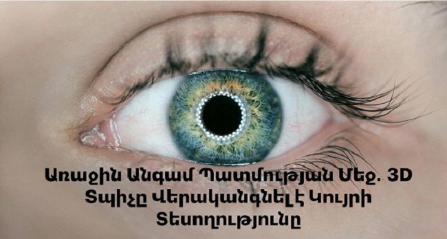 Առաջին Անգամ Պատմության Մեջ․ 3D Տպիչը Վերականգնել է Կույրի Տեսողությունը