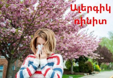 Ինչպե՞ս պայքարել գարնանային ալերգիայի դեմ