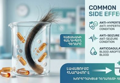 Դեղեր, որոնք «գողանում են» մեր մազերը. ի՞նչ պետք է գիտենա յուրաքանչյուրը